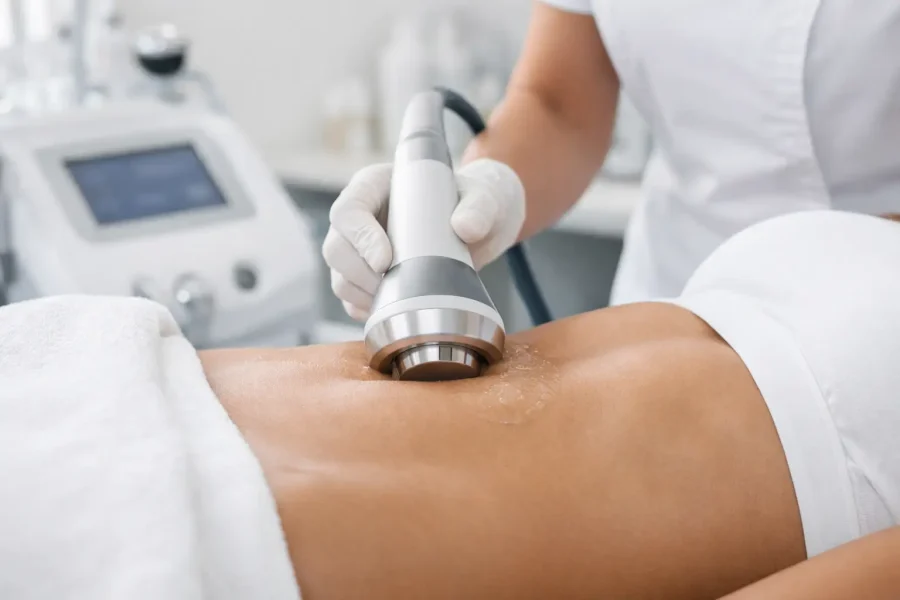 Fat Cavitation for Stomach: What to Expect